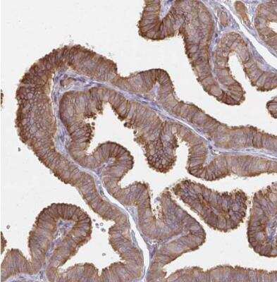 Immunohistochemistry-Paraffin: p190RhoGAP Antibody [NBP2-49172]