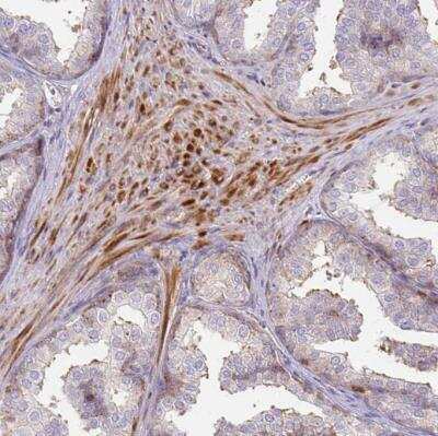 Immunohistochemistry-Paraffin: p190RhoGAP Antibody [NBP2-49229]