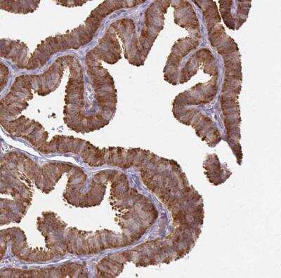 Immunohistochemistry-Paraffin: p190RhoGAP Antibody [NBP2-49229]