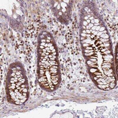 Immunohistochemistry-Paraffin: p190RhoGAP Antibody [NBP2-49229]