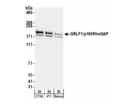 Western Blot: p190RhoGAP Antibody [NB100-88154]
