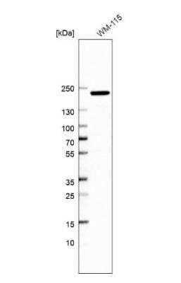 Western Blot: p190RhoGAP Antibody [NBP2-49172]