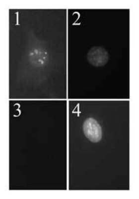 Immunocytochemistry/ Immunofluorescence: p19ARF/CDKN2A Antibody (12-A1-1) [NB200-169]