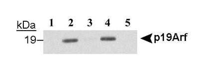 Immunoprecipitation: p19ARF/CDKN2A Antibody (12-A1-1) [NB200-169]
