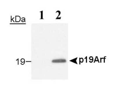 Western Blot: p19ARF/CDKN2A Antibody (12-A1-1) [NB200-169]