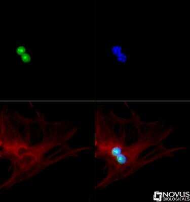 Immunocytochemistry/ Immunofluorescence: p19ARF/CDKN2A Antibody - BSA Free [NB200-106]