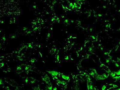 Immunohistochemistry: p19ARF/CDKN2A Antibody - BSA Free [NB200-106]