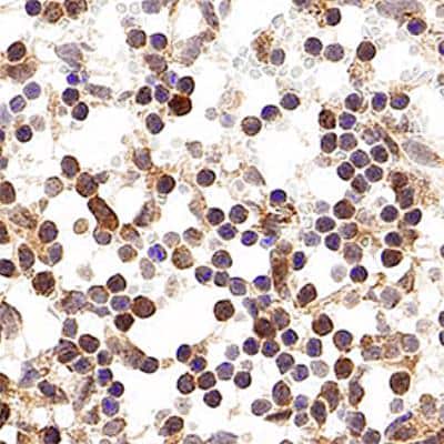 Immunohistochemistry-Paraffin: p19ARF/CDKN2A Antibody - BSA Free [NB200-106]
