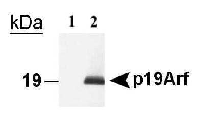 Western Blot: p19ARF/CDKN2A Antibody (5-C3-1)BSA Free [NB200-174]