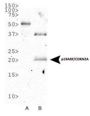 Western Blot: p19ARF/CDKN2A AntibodyBSA Free [NB200-106]