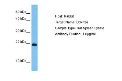 Western Blot: p19ARF/CDKN2A Antibody [NBP2-86741]