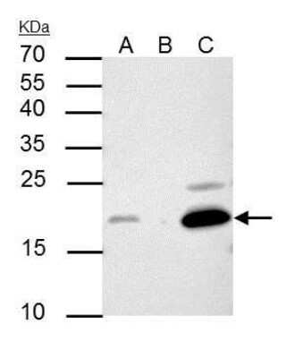 Immunoprecipitation: p21/CIP1/CDKN1A Antibody (1032) [NBP2-43697]