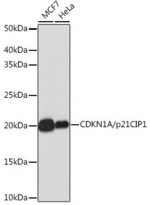 Western Blot: p21/CIP1/CDKN1A Antibody (4Z1H9) [NBP3-15661]