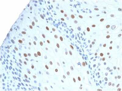 Immunohistochemistry-Paraffin: p21/CIP1/CDKN1A Antibody (CIP1/2275R) - Azide and BSA Free [NBP2-80489]