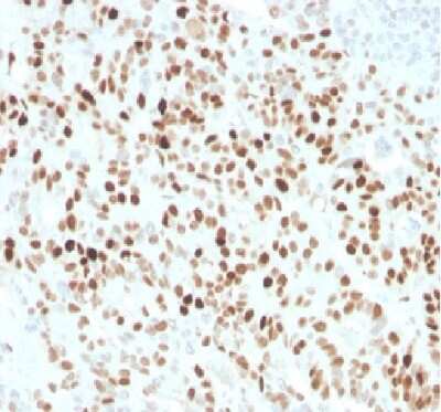 Immunohistochemistry-Paraffin: p21/CIP1/CDKN1A Antibody (CIP1/4377R) - Azide and BSA Free [NBP3-08961]
