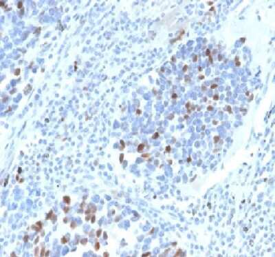 Immunohistochemistry-Paraffin: p21/CIP1/CDKN1A Antibody (CIP1/4377R) - Azide and BSA Free [NBP3-08961]