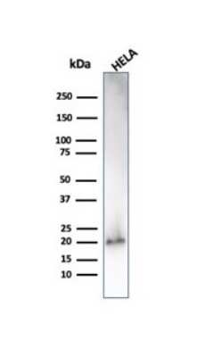 Western Blot: p21/CIP1/CDKN1A Antibody (CIP1/4377R)Azide and BSA Free [NBP3-08961]