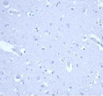 Immunohistochemistry-Paraffin: p21/CIP1/CDKN1A Antibody (CIP1/4377R) [NBP3-07215]