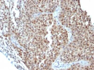Immunohistochemistry-Paraffin: p21/CIP1/CDKN1A Antibody (CIP1/823 + DCS-60.2) [NBP2-44529]