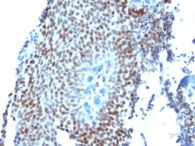 Immunohistochemistry-Paraffin: p21/CIP1/CDKN1A Antibody (CIP1/823) - Azide and BSA Free [NBP2-47783]