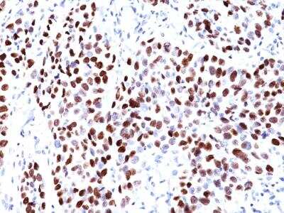 Immunohistochemistry-Paraffin: p21/CIP1/CDKN1A Antibody (CIP1/823) - IHC-Prediluted [NBP2-48371]