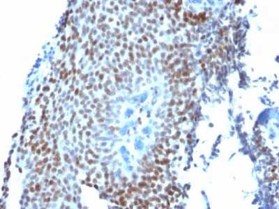 Immunohistochemistry-Paraffin: p21/CIP1/CDKN1A Antibody (CIP1/823) [NBP2-44527]
