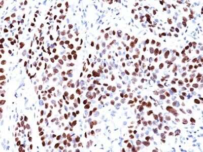 Immunohistochemistry-Paraffin: p21/CIP1/CDKN1A Antibody (CIP1/823) [NBP2-44527]