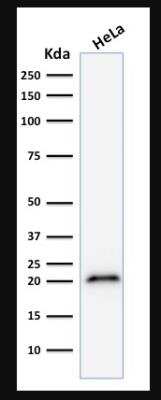 Western Blot: p21/CIP1/CDKN1A Antibody (CIP1/823) [NBP2-44527]