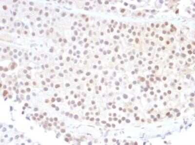 Immunohistochemistry-Paraffin: p21/CIP1/CDKN1A Antibody (DCS-60.2) - Azide and BSA Free [NBP2-47781]