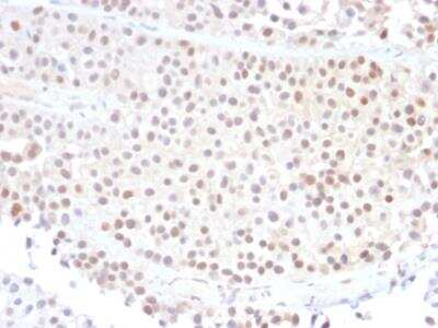 Immunohistochemistry-Paraffin: p21/CIP1/CDKN1A Antibody (DCS-60.2) - IHC-Prediluted [NBP2-48351]