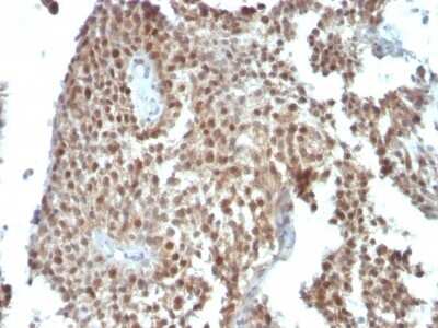Immunohistochemistry-Paraffin: p21/CIP1/CDKN1A Antibody (SPM306) - Azide and BSA Free [NBP2-47782]