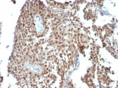 Immunohistochemistry-Paraffin: p21/CIP1/CDKN1A Antibody (SPM306) - IHC-Prediluted [NBP2-48352]