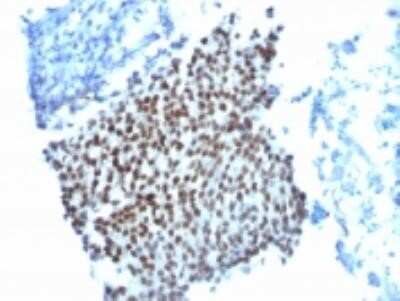 Immunohistochemistry-Paraffin: p21/CIP1/CDKN1A Antibody (WA-1) - Azide and BSA Free [NBP2-33084]