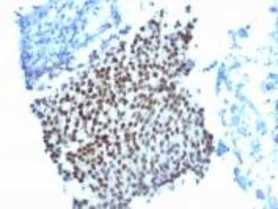 Immunohistochemistry-Paraffin: p21/CIP1/CDKN1A Antibody (WA-1) [NBP2-29463]