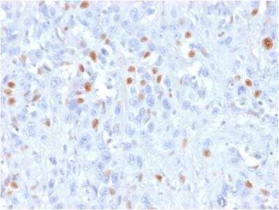 Immunohistochemistry-Paraffin: p21/CIP1/CDKN1A Antibody (rCIP1/823) [NBP3-09173]
