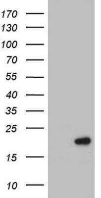 Western Blot: p23/PTGES3 Antibody (OTI2D2) [NBP2-45457]