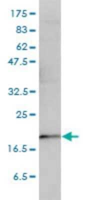 Western Blot: p23/PTGES3 Antibody (3H1-2A8) [H00010728-M01]