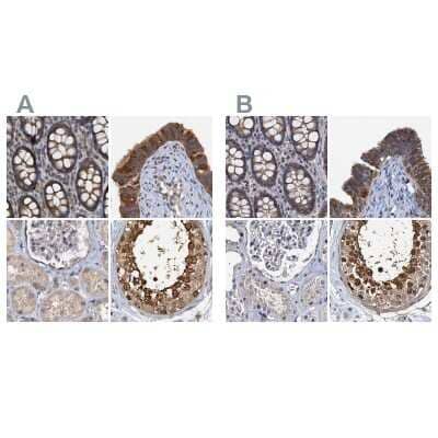 Immunohistochemistry-Paraffin: p23/PTGES3 Antibody [NBP1-85485]