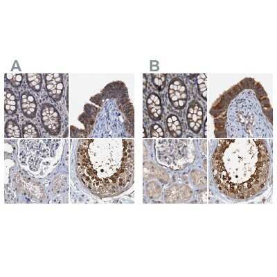 Immunohistochemistry-Paraffin: p23/PTGES3 Antibody [NBP1-85486]