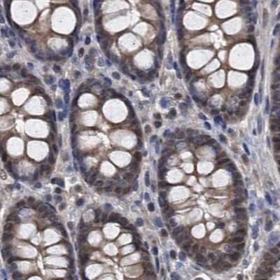 Immunohistochemistry-Paraffin: p23/PTGES3 Antibody [NBP1-85486]