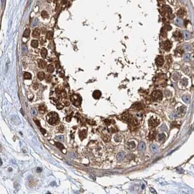 Immunohistochemistry-Paraffin: p23/PTGES3 Antibody [NBP1-85486]