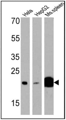 Western Blot: p23/PTGES3 Antibody (JJ3) [NB300-576]