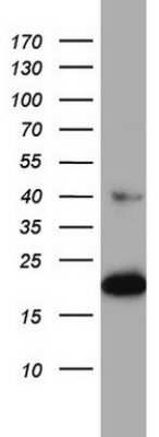Western Blot: p23/PTGES3 Antibody (OTI2D2)Azide and BSA Free [NBP2-73186]