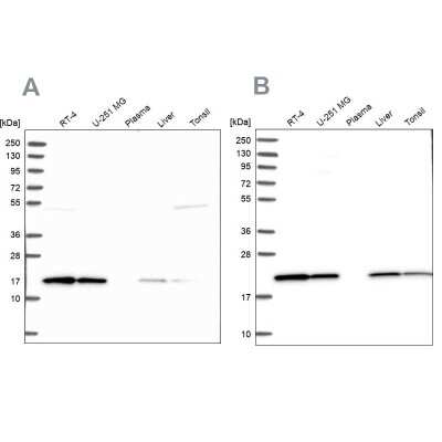 Western Blot: p23/PTGES3 Antibody [NBP1-85485]