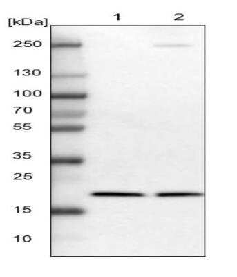 Western Blot: p23/PTGES3 Antibody [NBP1-85485]