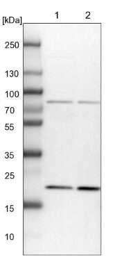 Western Blot: p23/PTGES3 Antibody [NBP1-85486]