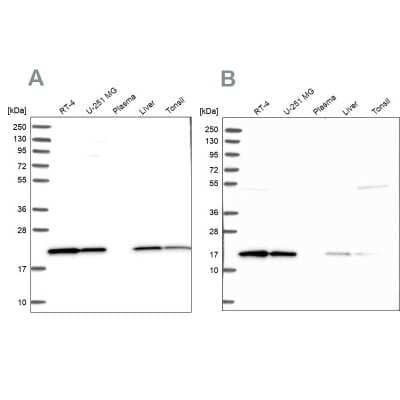 Western Blot: p23/PTGES3 Antibody [NBP1-85486]