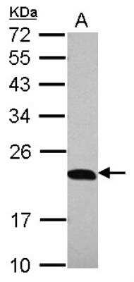 Western Blot: p23/PTGES3 Antibody [NBP2-19998]