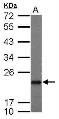 Western Blot: p23/PTGES3 Antibody [NBP2-19998]