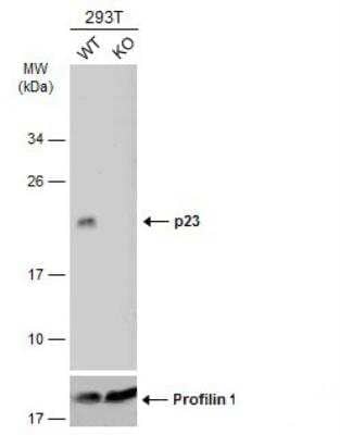 Western Blot: p23/PTGES3 Antibody [NBP2-19998]